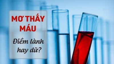 Mơ thấy máu đánh con gì giúp bet thủ thắng lớn?